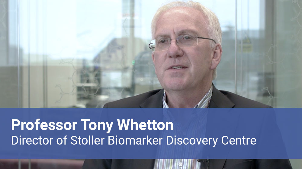 tony-whetton